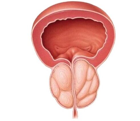 Zvýšená prostata a liečba kapsúl Urosaf